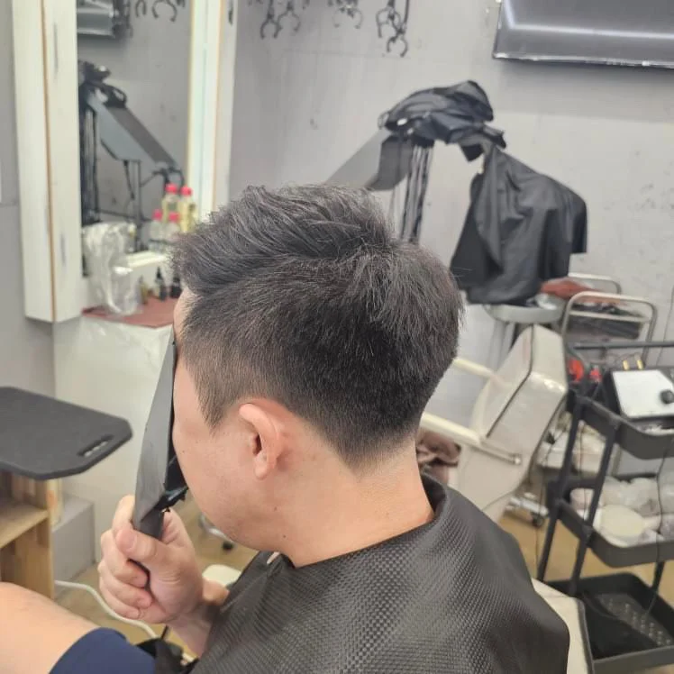 입춘 플라즈마 PDRN 두피 재생 케어 시술 전 플라즈마PDRN 모습