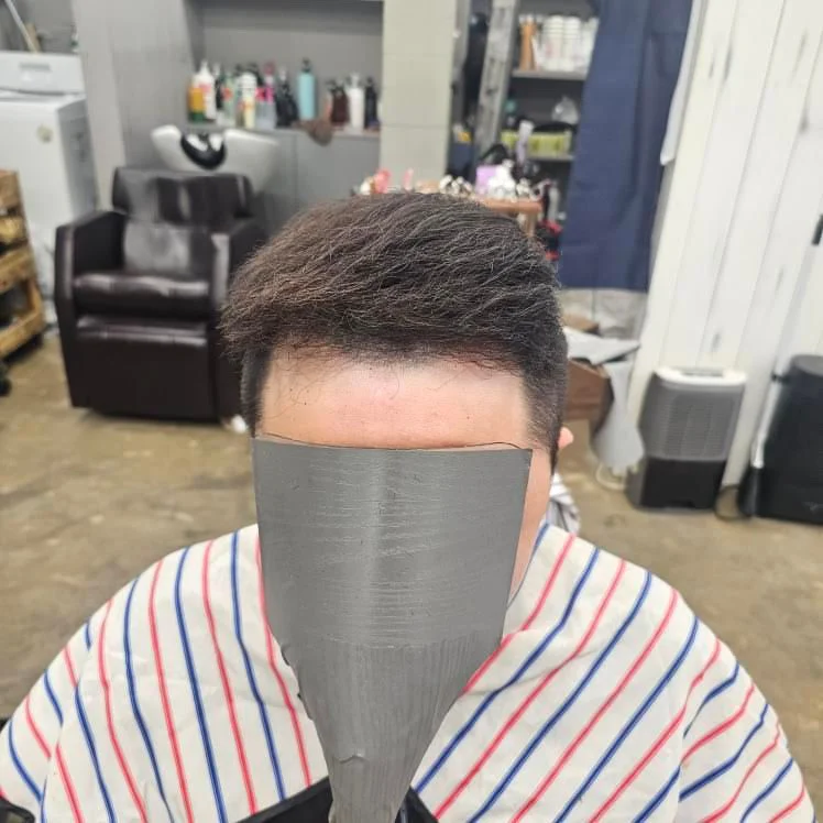 입춘 플라즈마 PDRN 두피 재생 케어 시술 후 플라즈마PDRN 결과