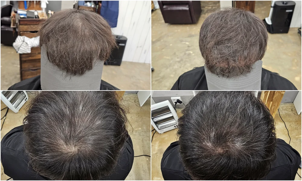 두피페인팅 (치트염색) 시술 대표 사진