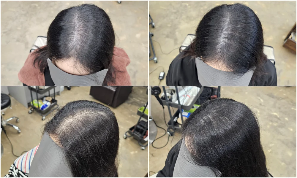 두피페인팅 (치트염색) 시술 대표 사진