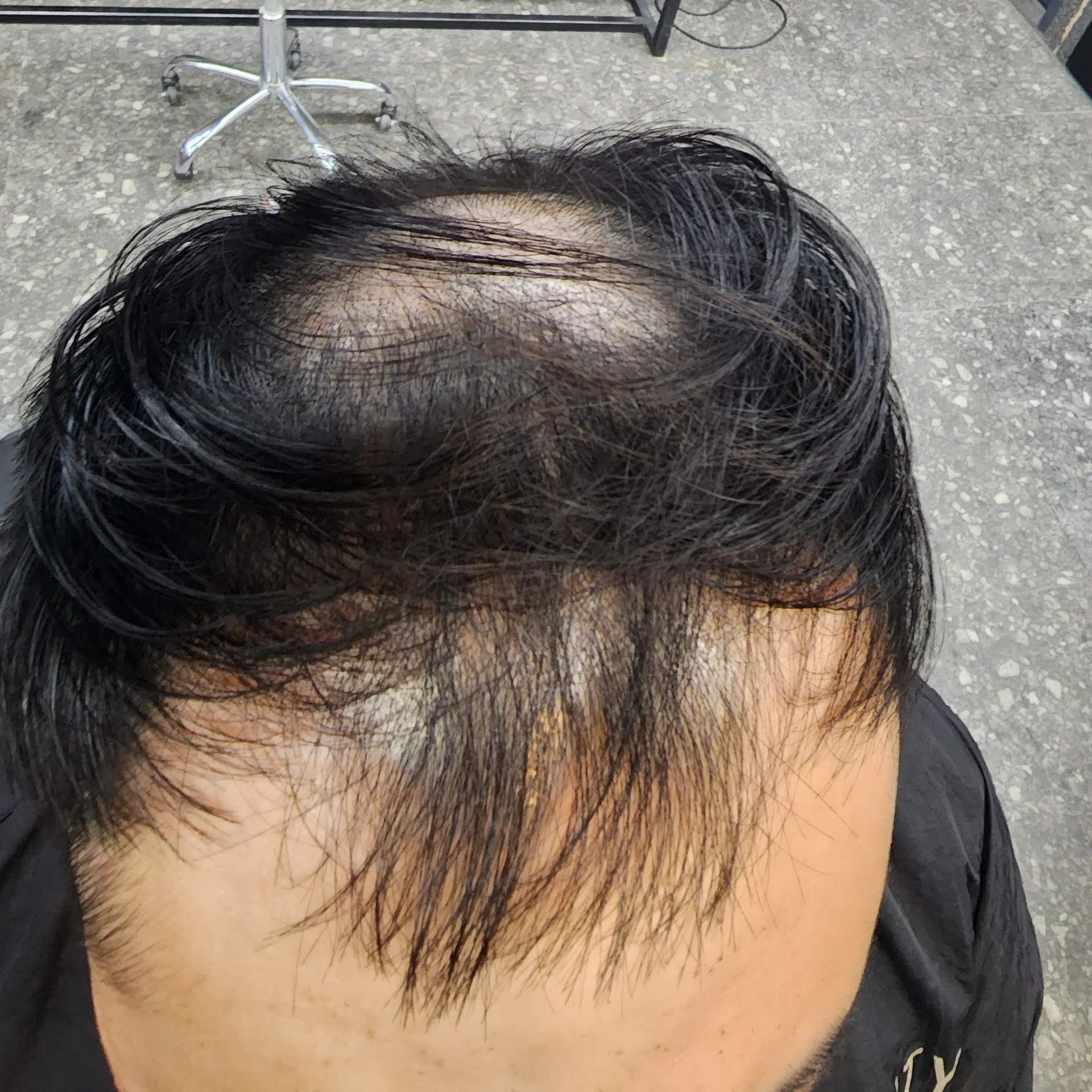 두피페인팅 (치트염색) 시술 대표 사진