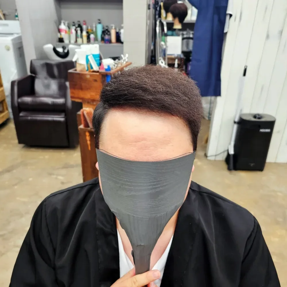 탈모 치트펌 시술 후 탈모펌 결과