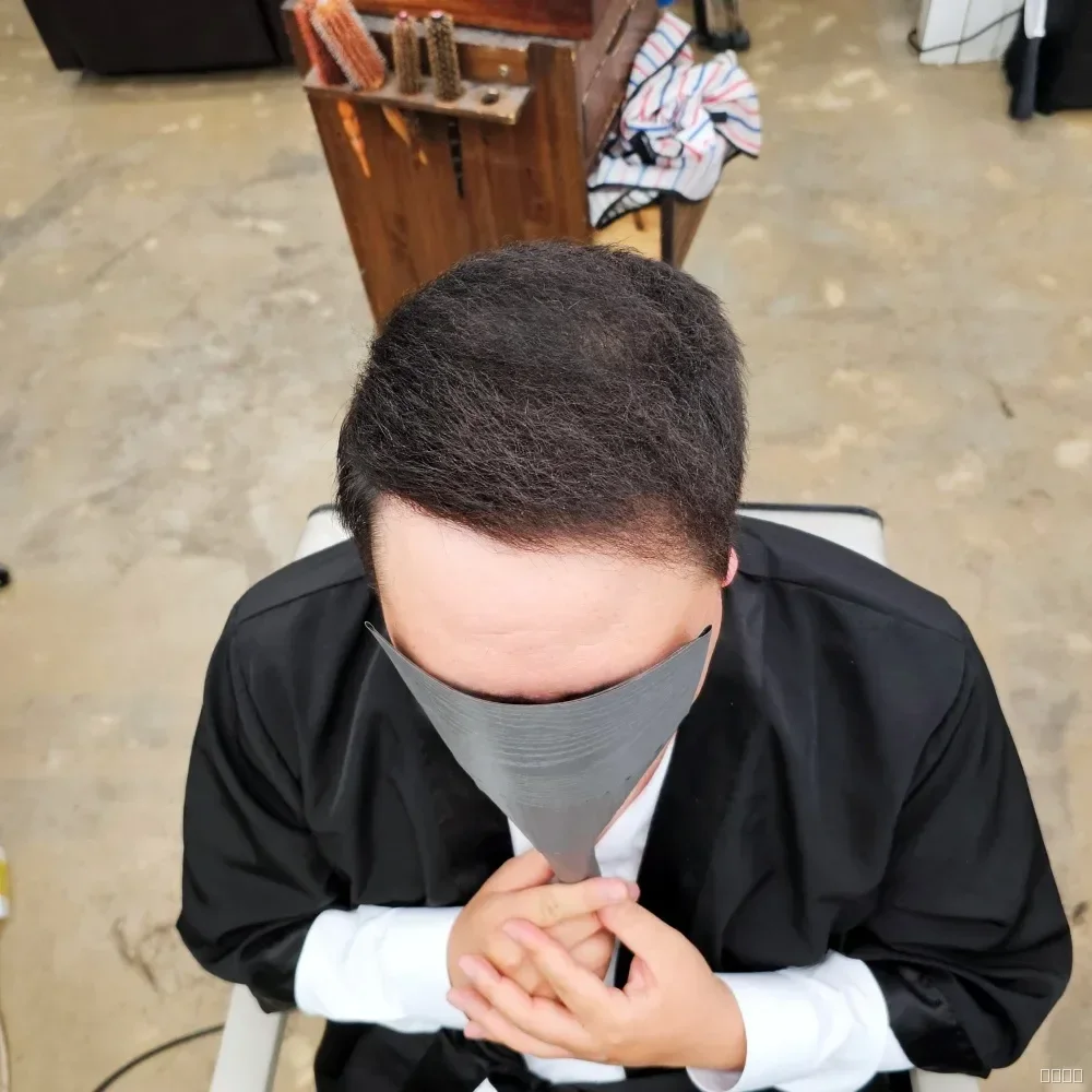 탈모 치트펌 시술 후 결과 사진 2