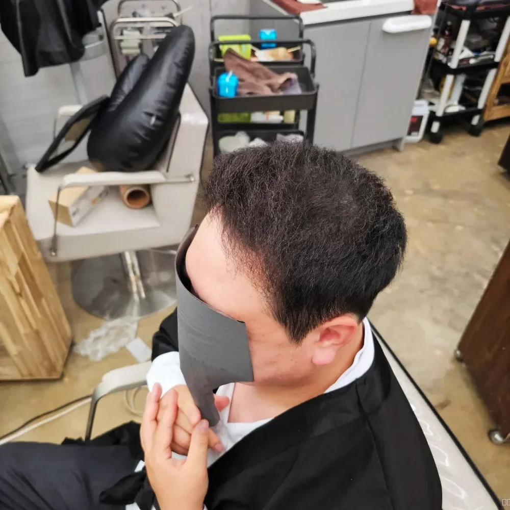 탈모 치트펌 시술 후 결과 사진 3