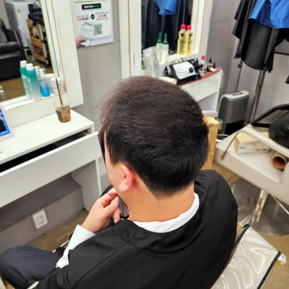 탈모 치트펌 시술 후 결과 사진 4