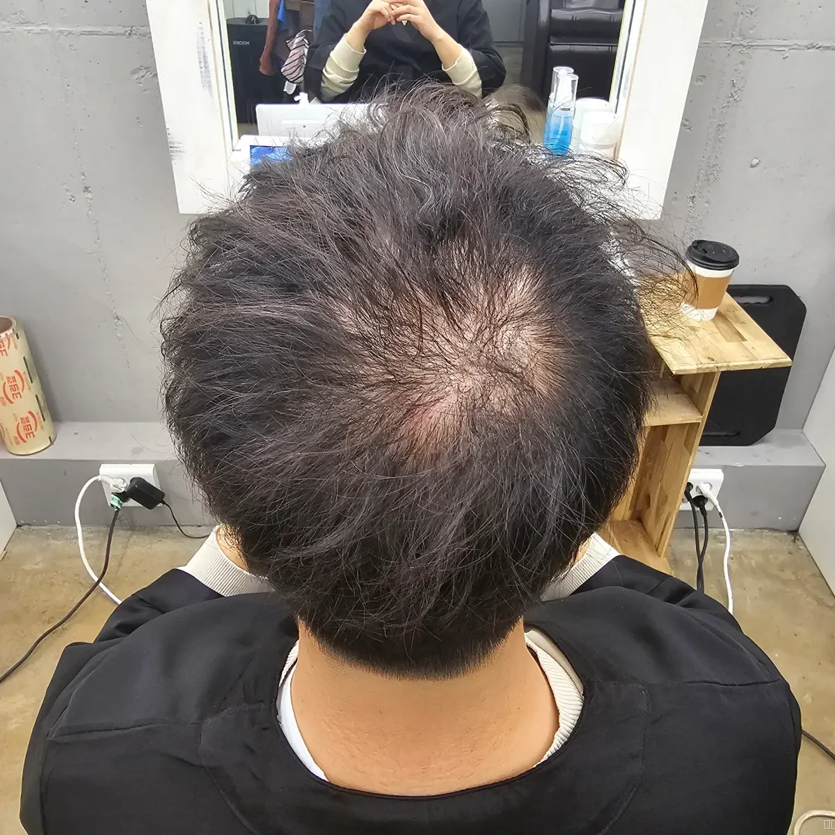 두피페인팅 (치트염색) 시술 전 사진 2