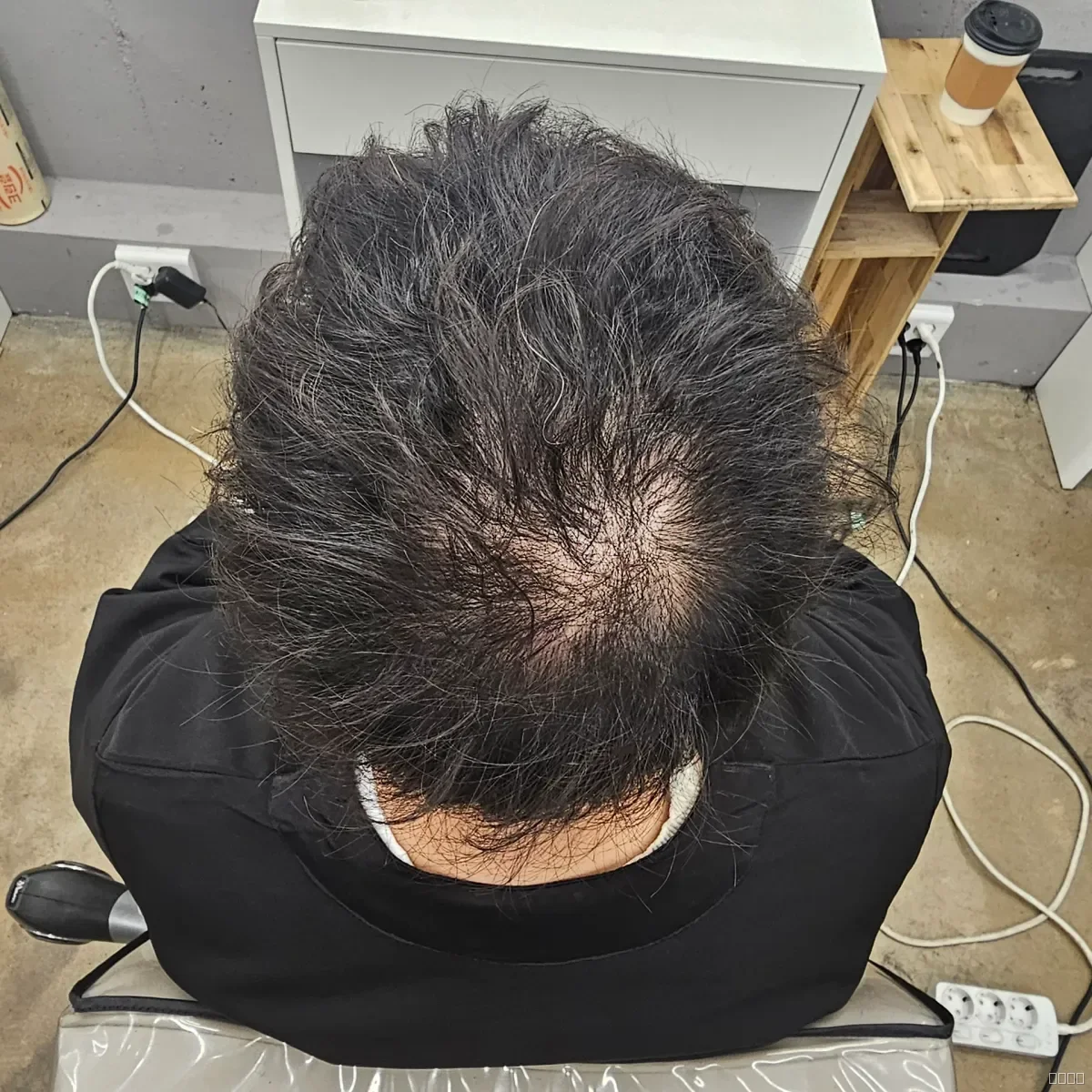 두피페인팅 (치트염색) 시술 전 사진 3