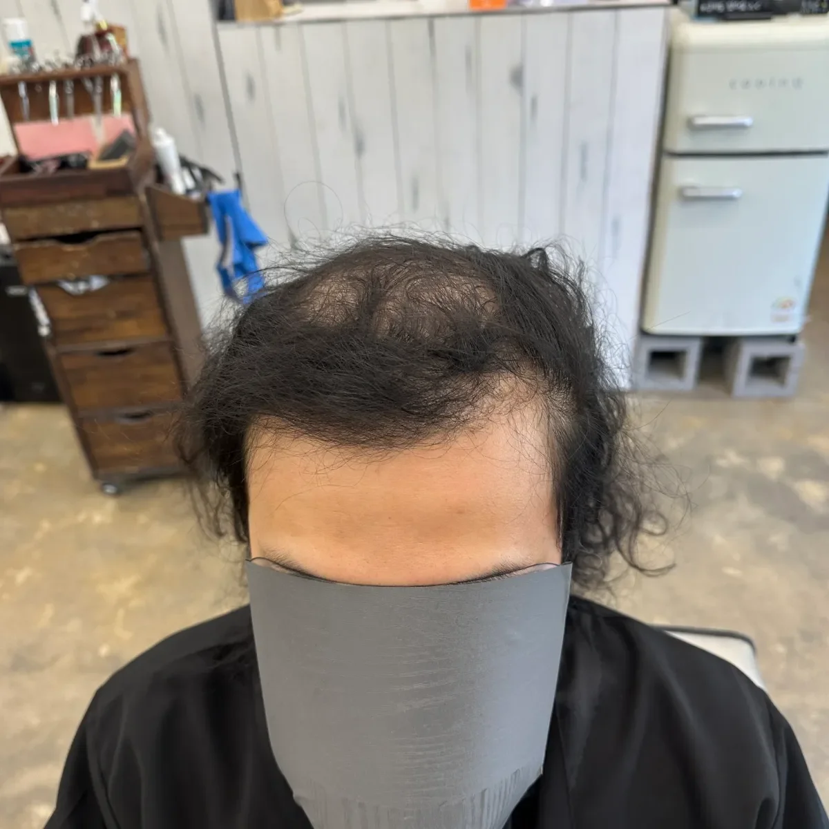 두피페인팅 (치트염색) 시술 전 두피페인팅 모습