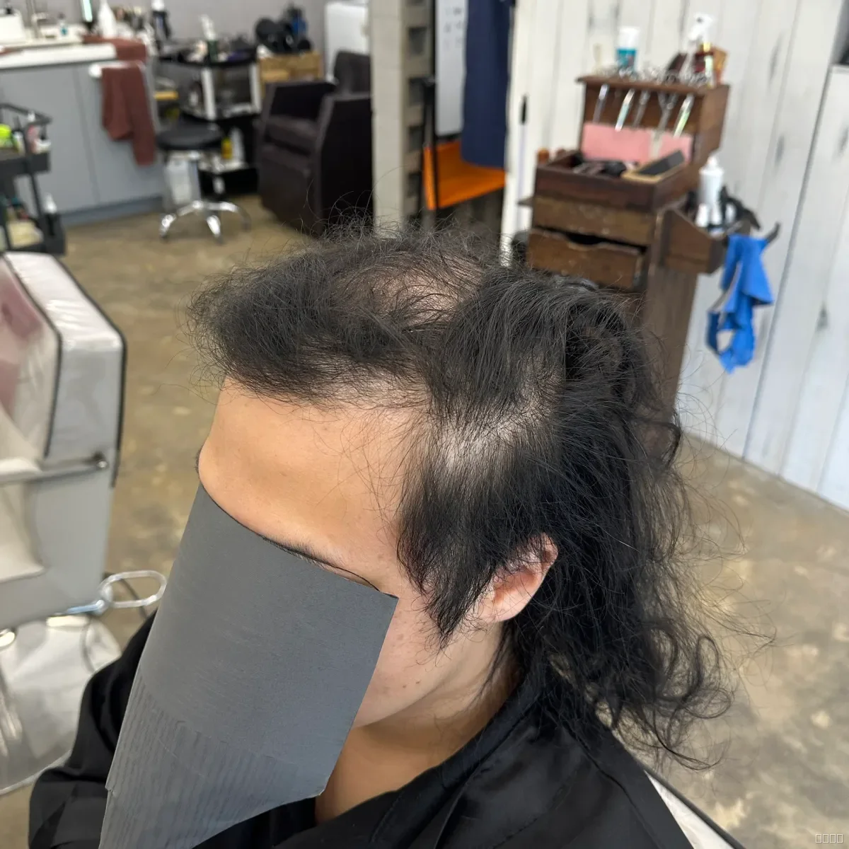 두피페인팅 (치트염색) 시술 전 사진 2