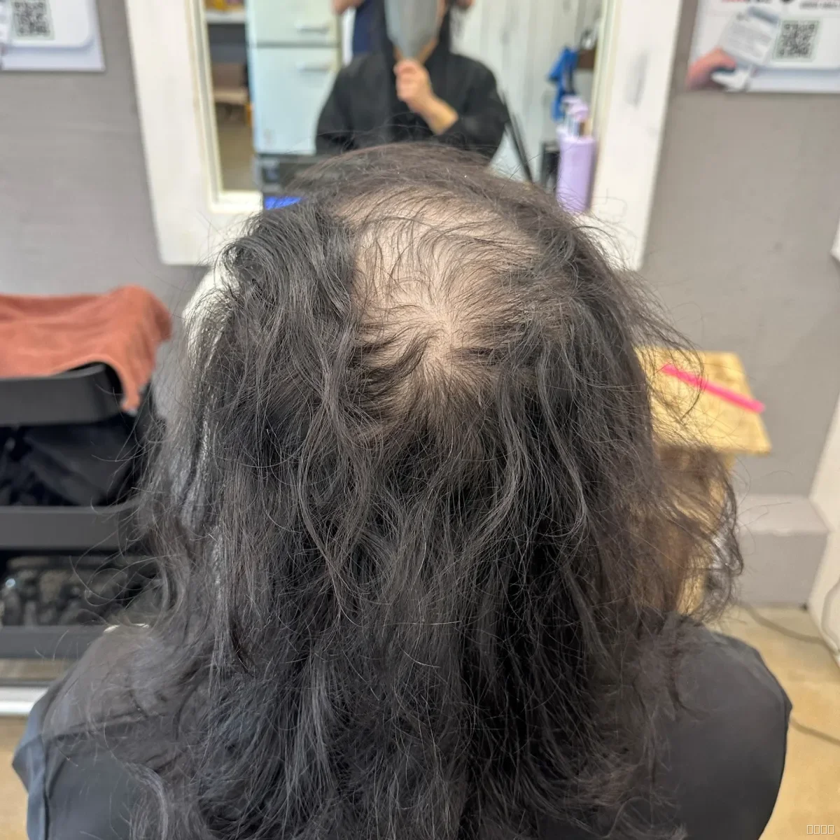 두피페인팅 (치트염색) 시술 전 사진 3