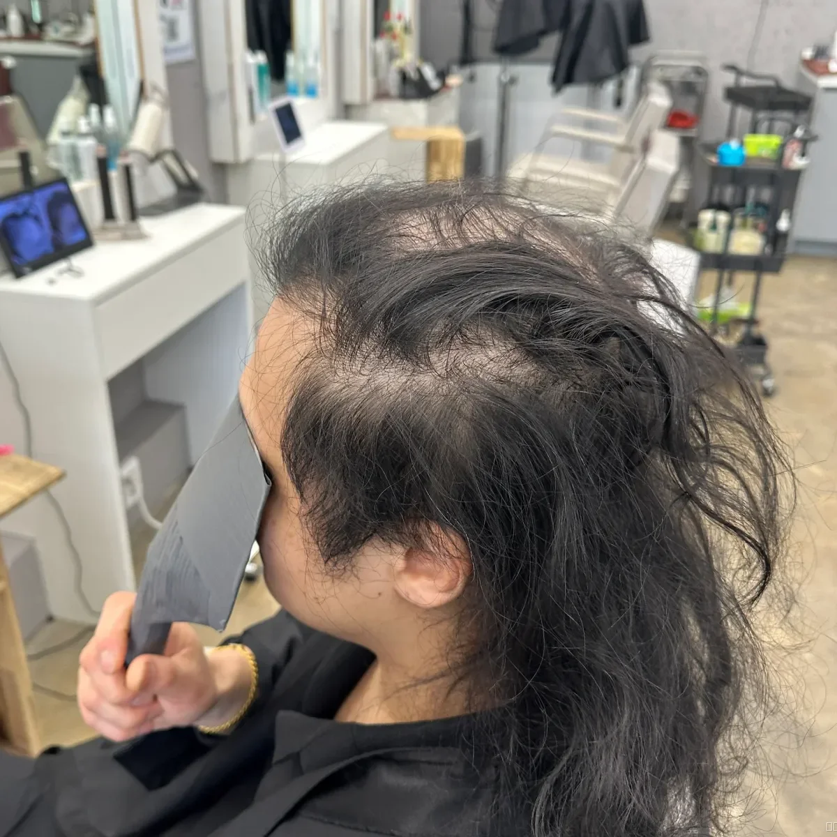 두피페인팅 (치트염색) 시술 전 사진 5