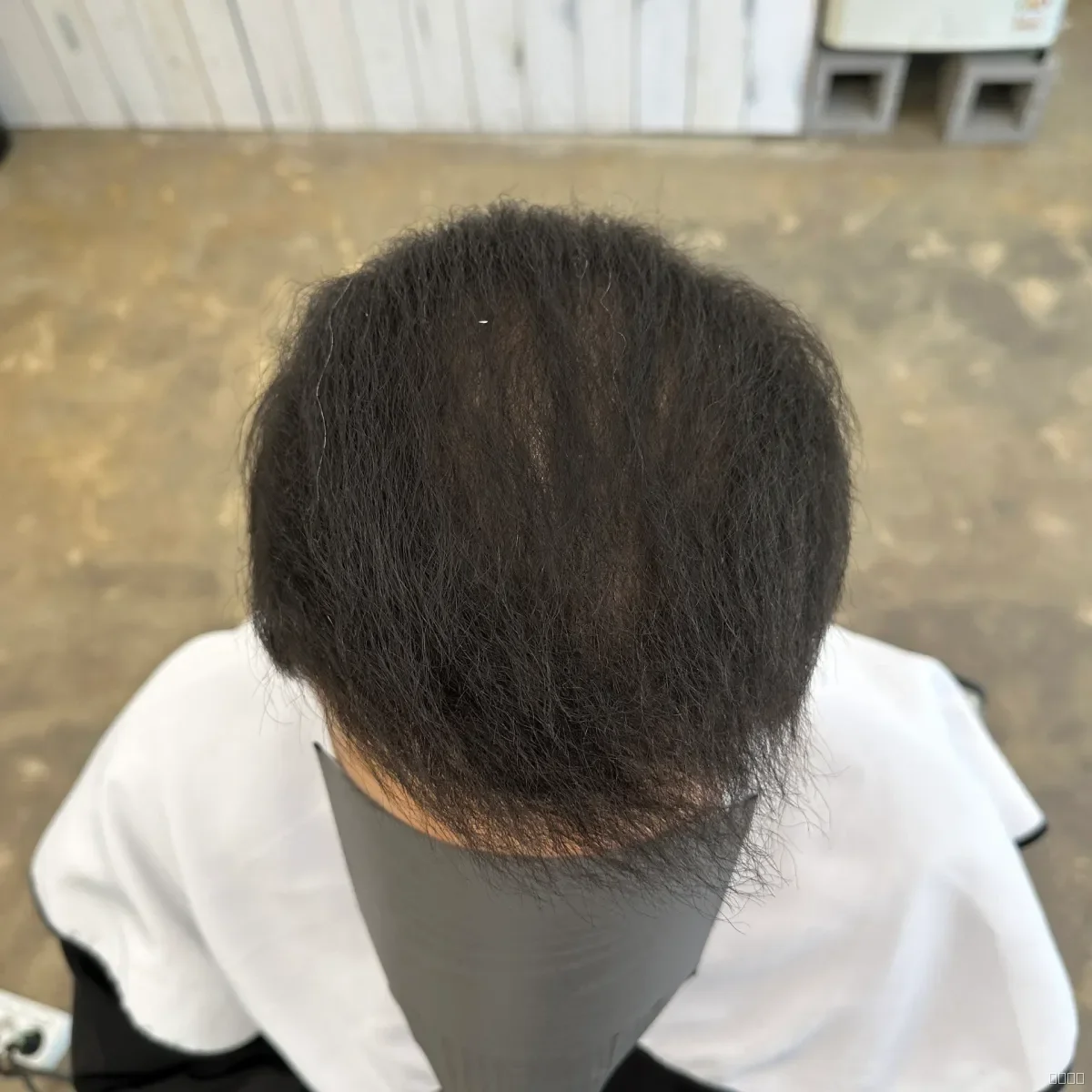 두피페인팅 (치트염색) 시술 후 두피페인팅 결과