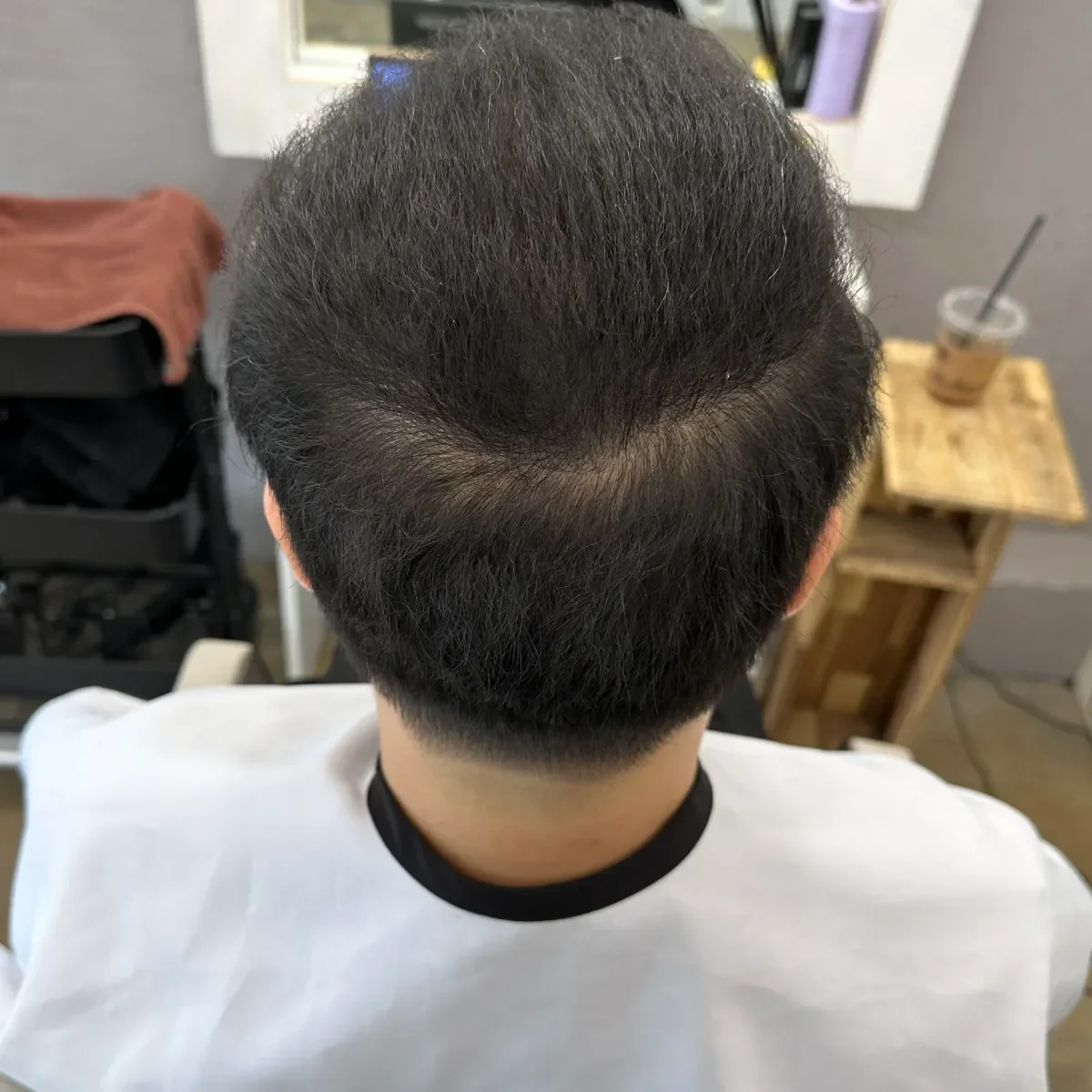 두피페인팅 (치트염색) 시술 후 결과 사진 6