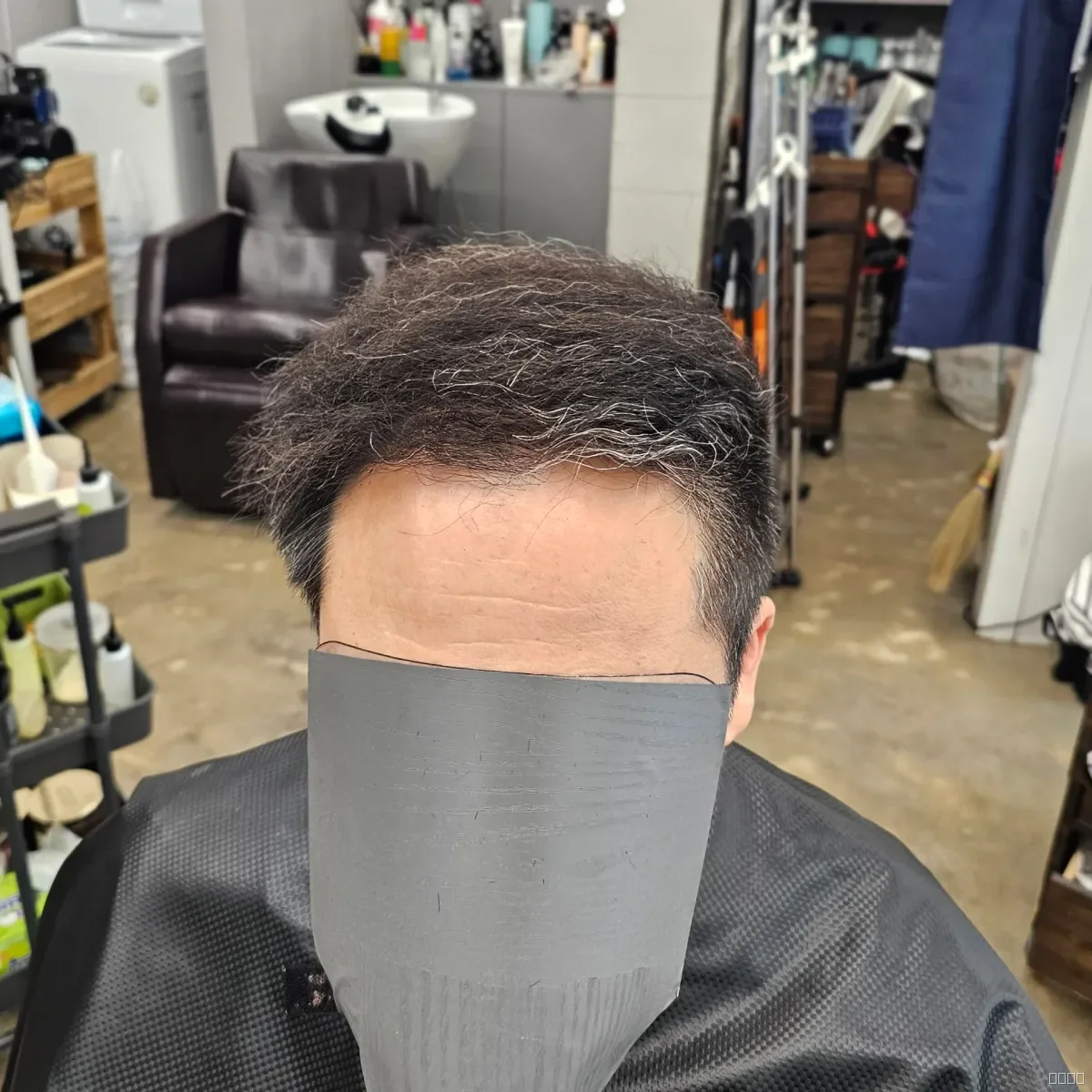 탈모 치트펌 시술 후 결과 사진 2