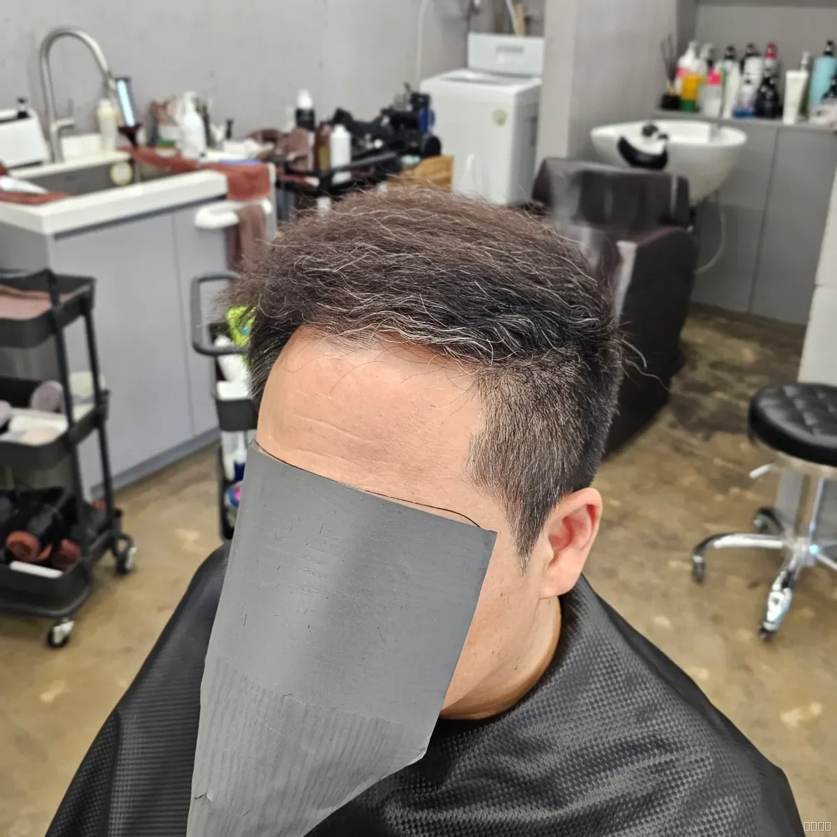 탈모 치트펌 시술 후 결과 사진 3