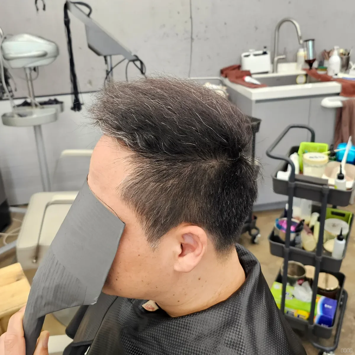 탈모 치트펌 시술 후 결과 사진 4