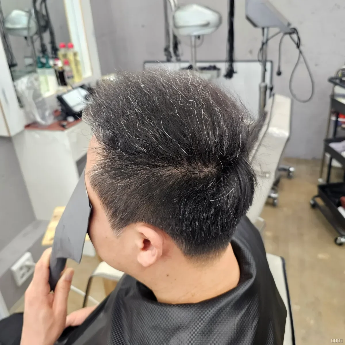 탈모 치트펌 시술 후 결과 사진 5