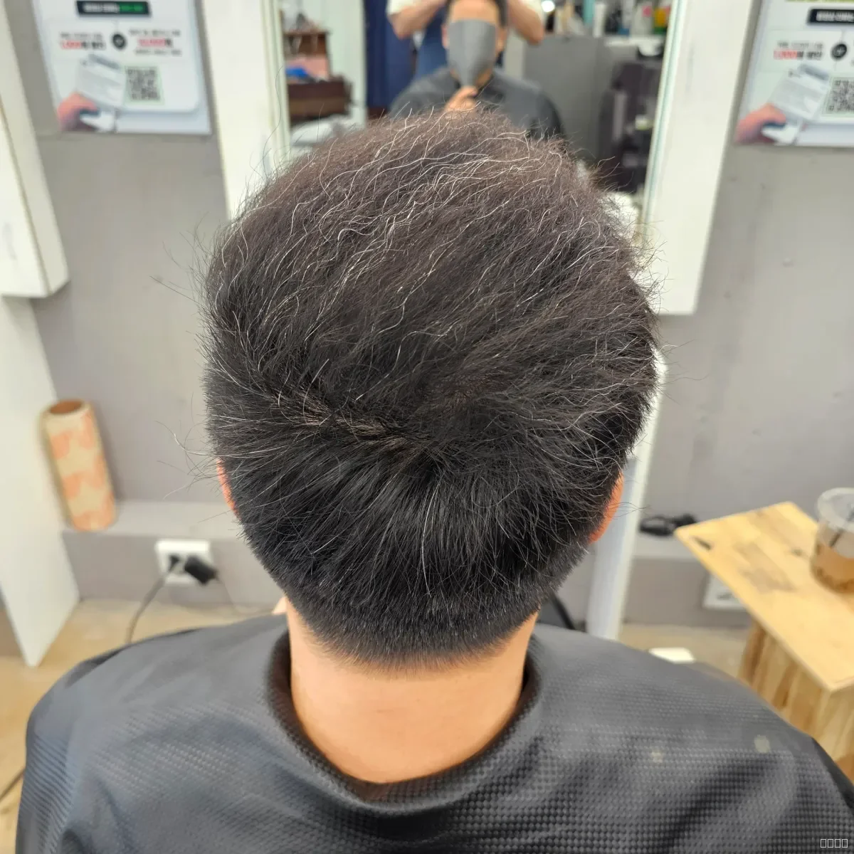 탈모 치트펌 시술 후 결과 사진 6