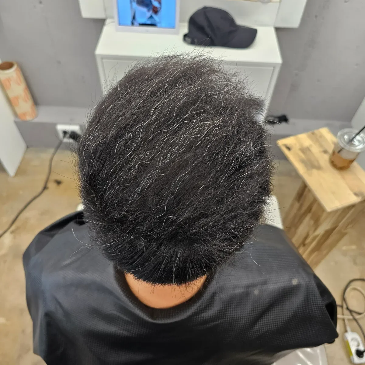 탈모 치트펌 시술 후 결과 사진 7