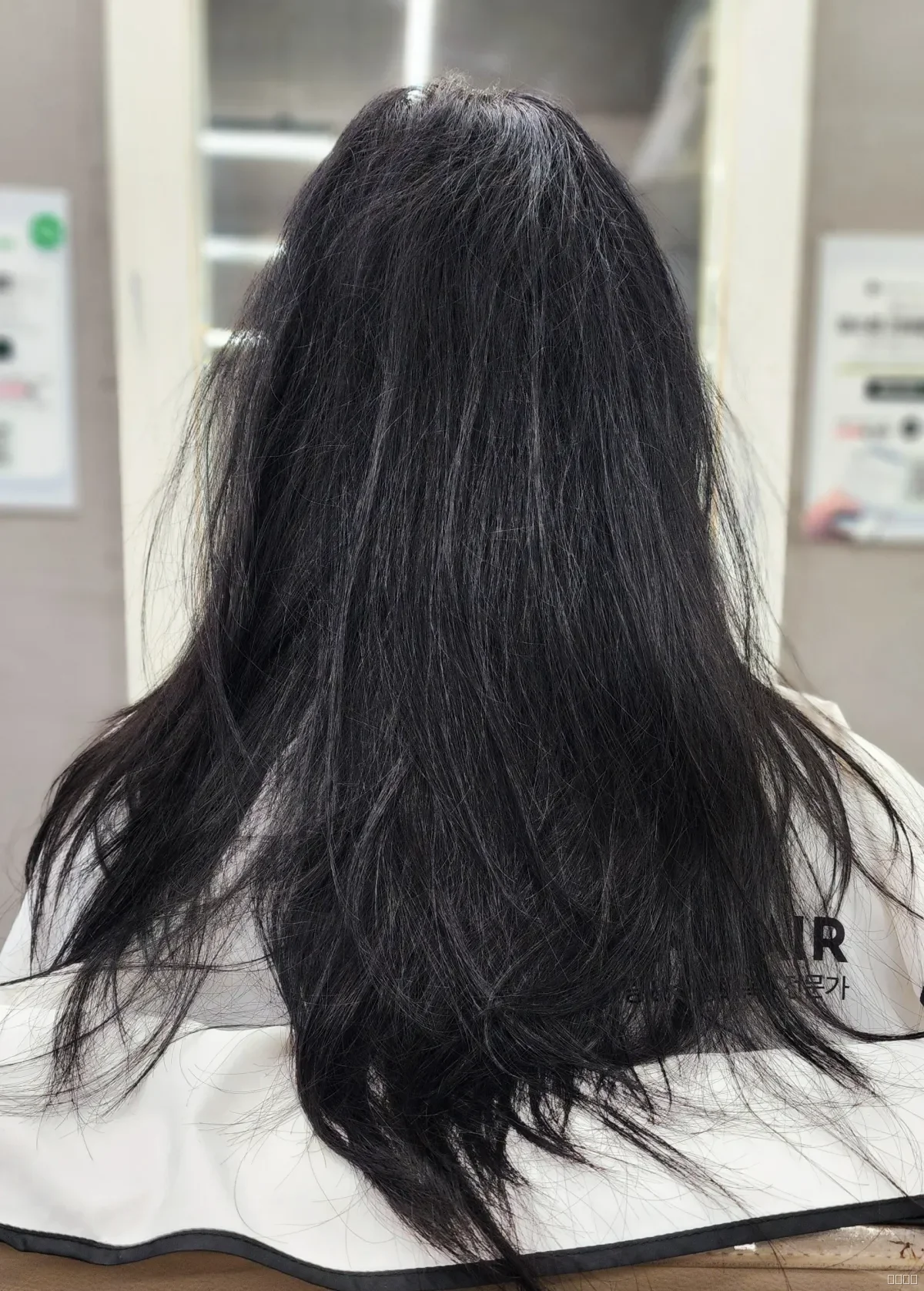 복구매직 시술 전 사진 2