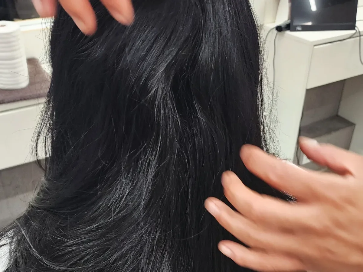 복구매직 시술 전 사진 4