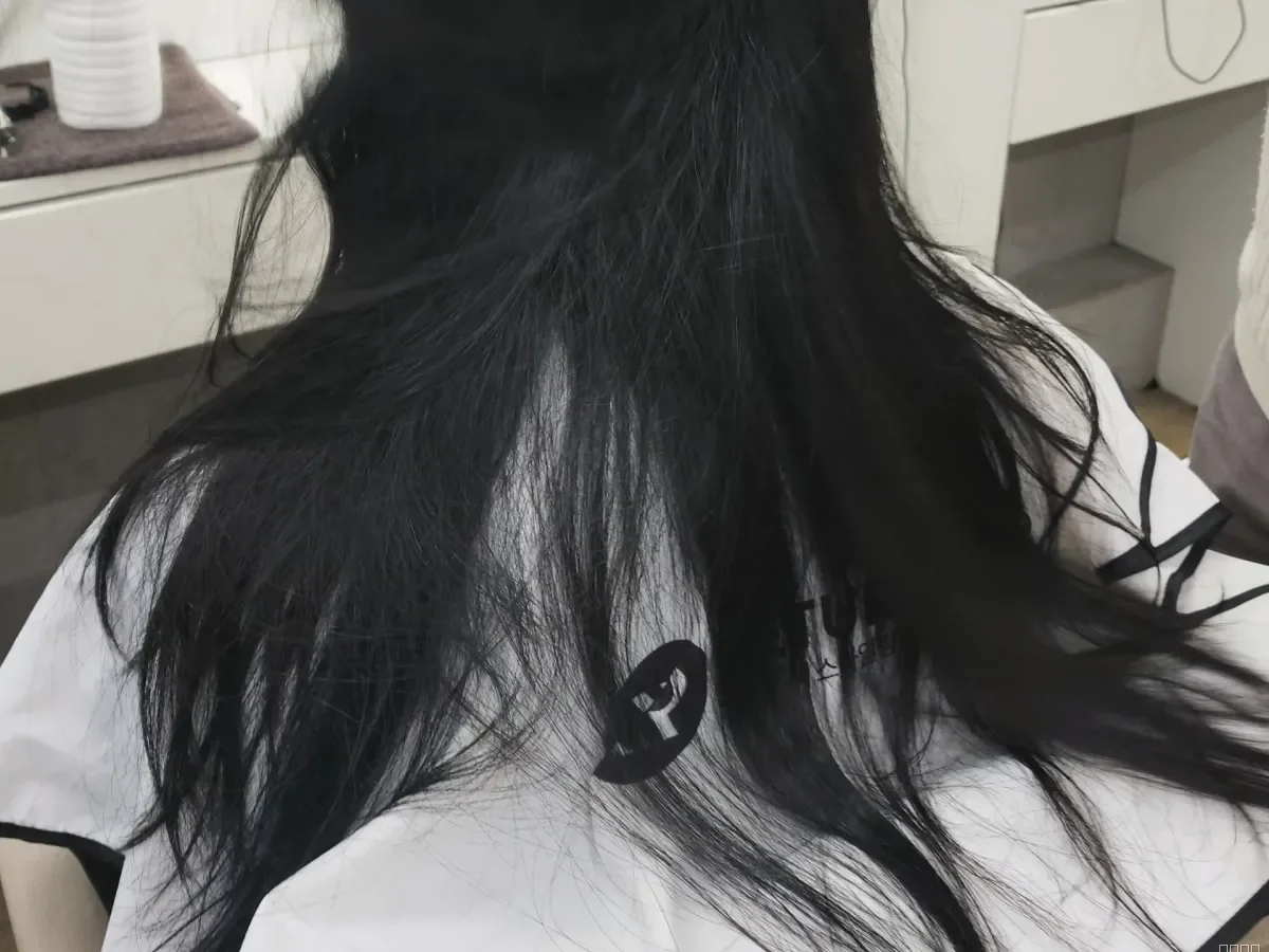 복구매직 시술 전 사진 5