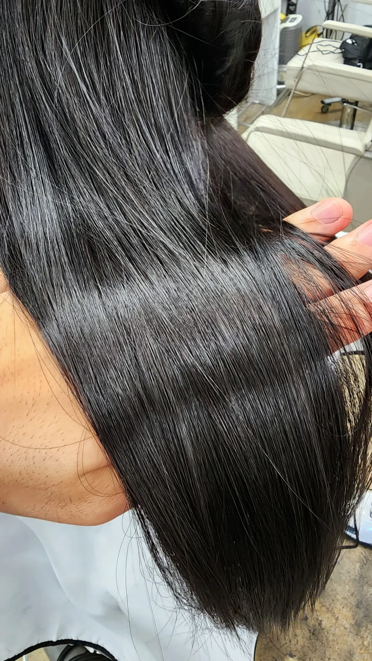 복구매직 시술 후 안양복구매직 결과