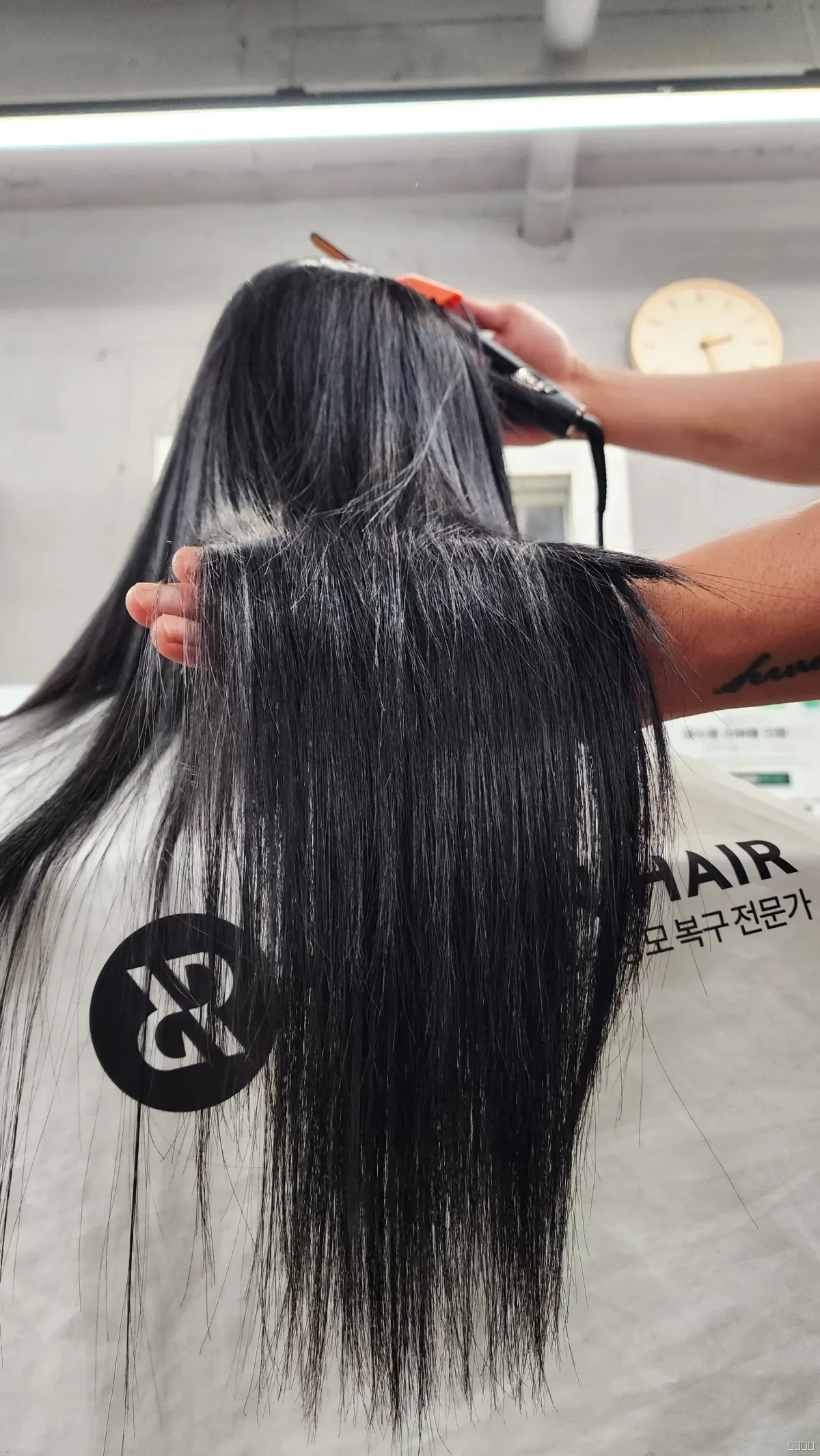 복구매직 시술 후 결과 사진 2