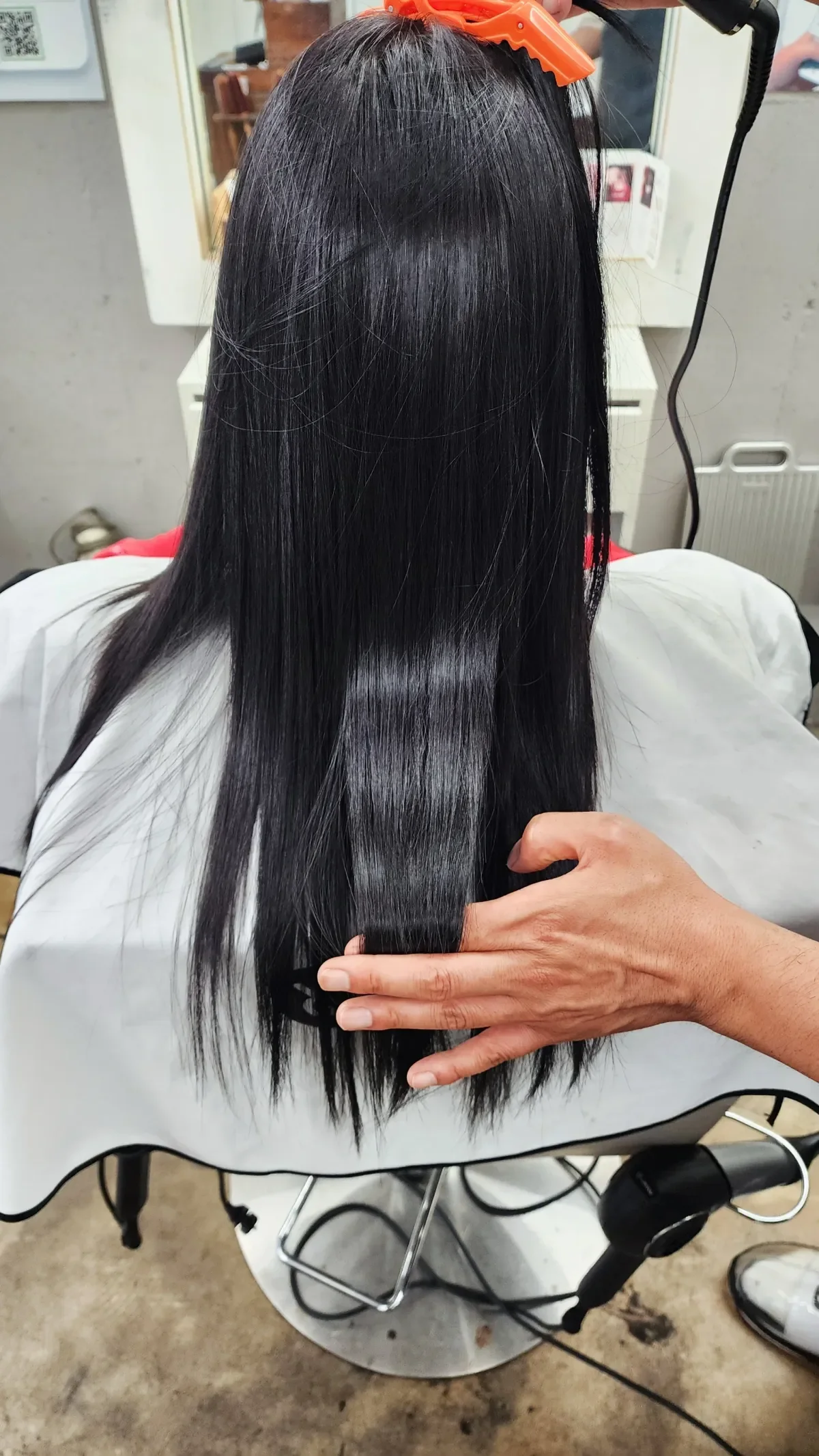 복구매직 시술 후 결과 사진 3