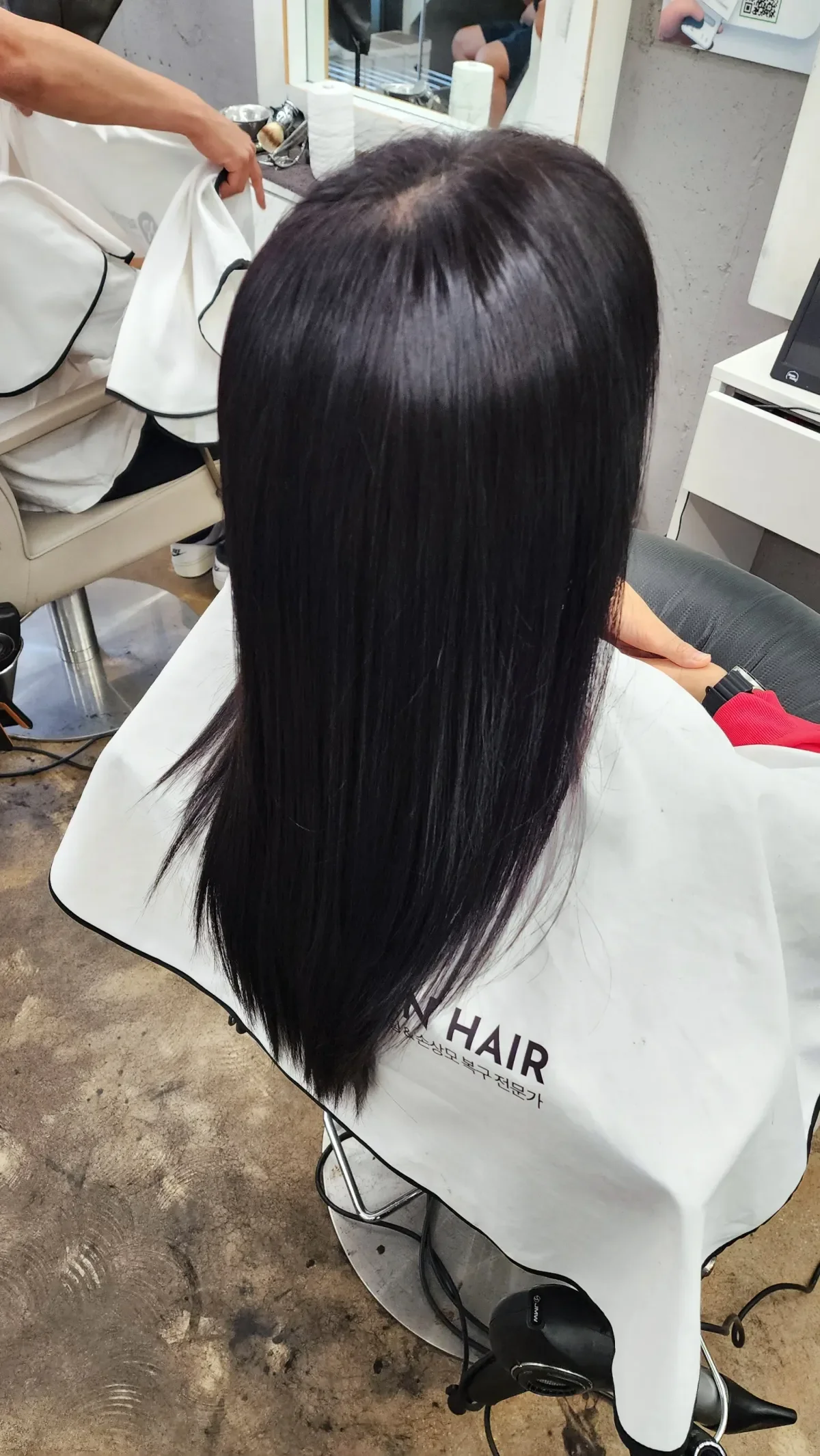 복구매직 시술 후 결과 사진 4