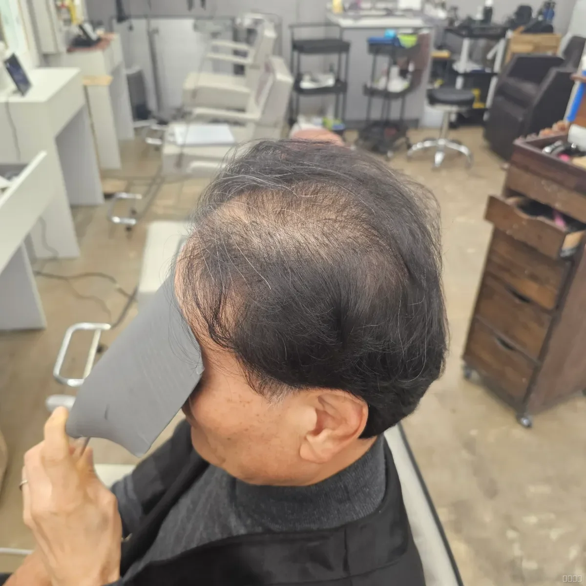 두피페인팅 (치트염색) 시술 전 용인두피페인팅 모습