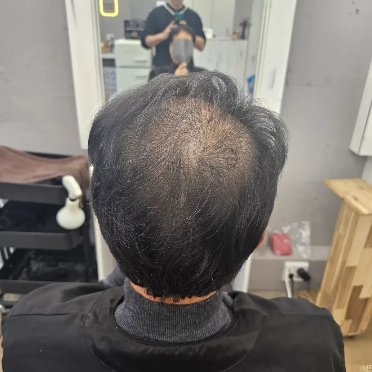 두피페인팅 (치트염색) 시술 전 사진 2