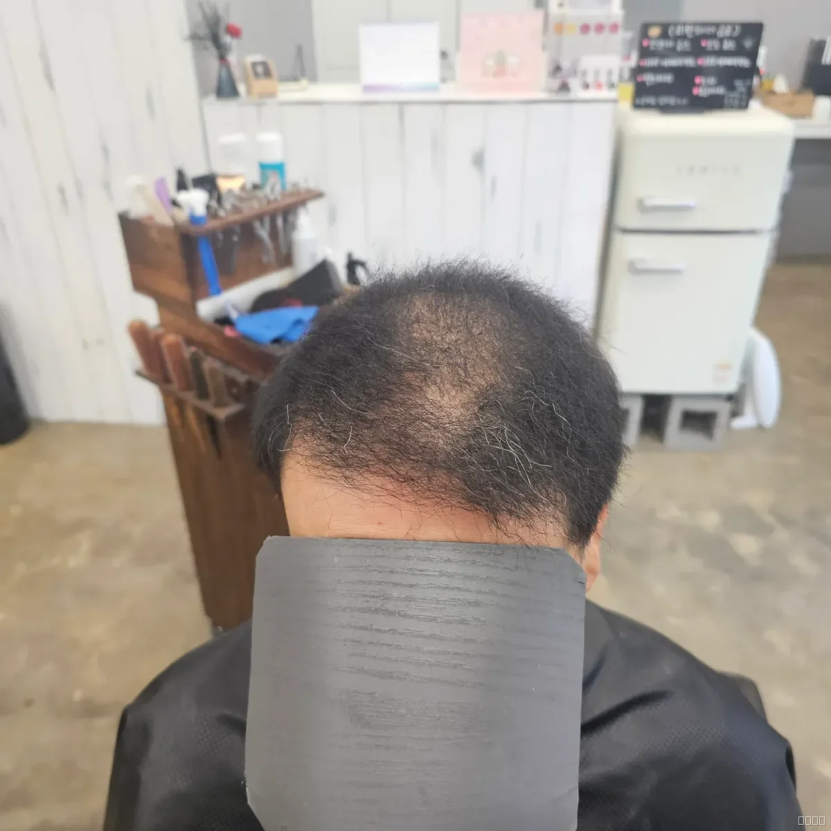 두피페인팅 (치트염색) 시술 전 사진 4