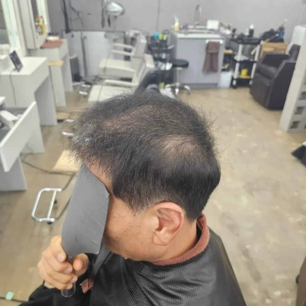 두피페인팅 (치트염색) 시술 전 사진 5