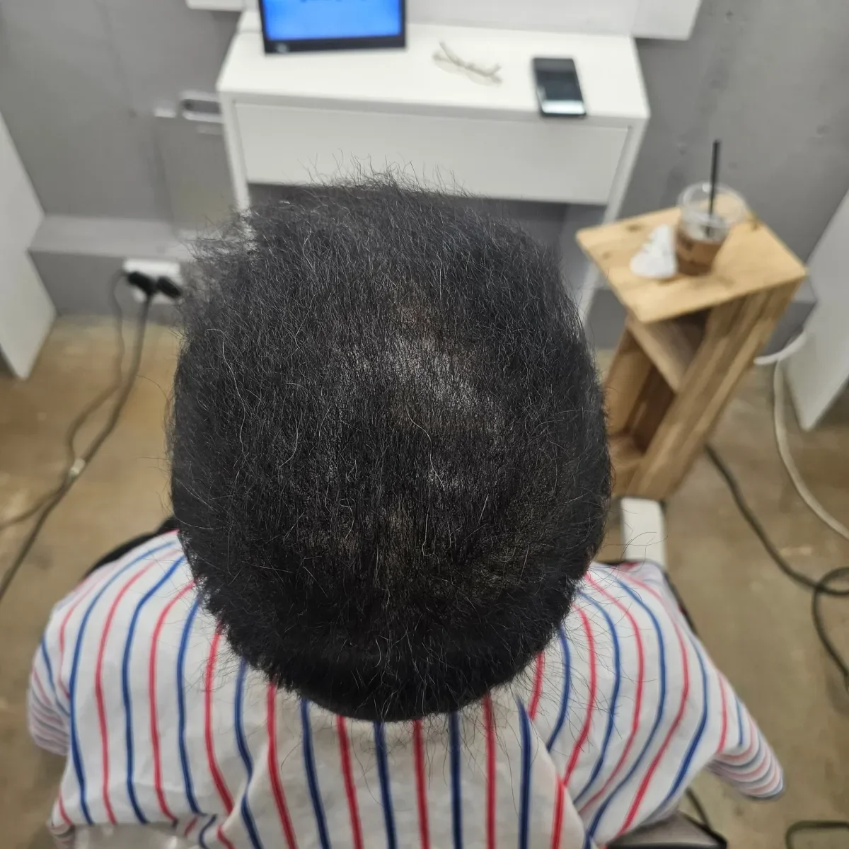 두피페인팅 (치트염색) 시술 후 결과 사진 4