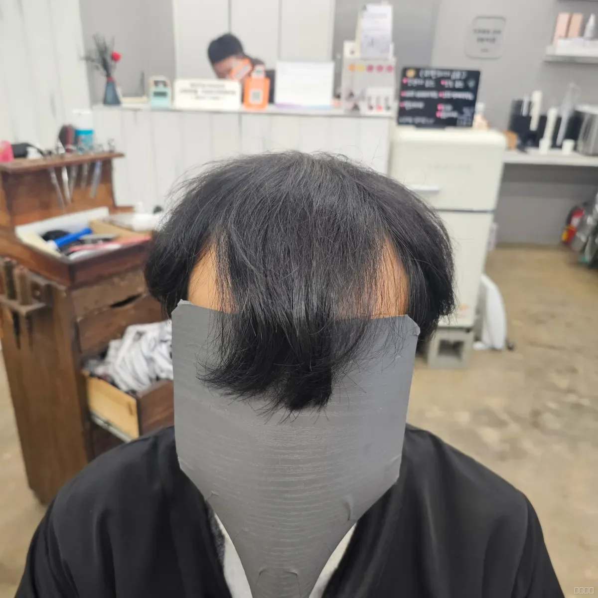 탈모 치트펌 시술 전 산본 정수리 탈모 모습