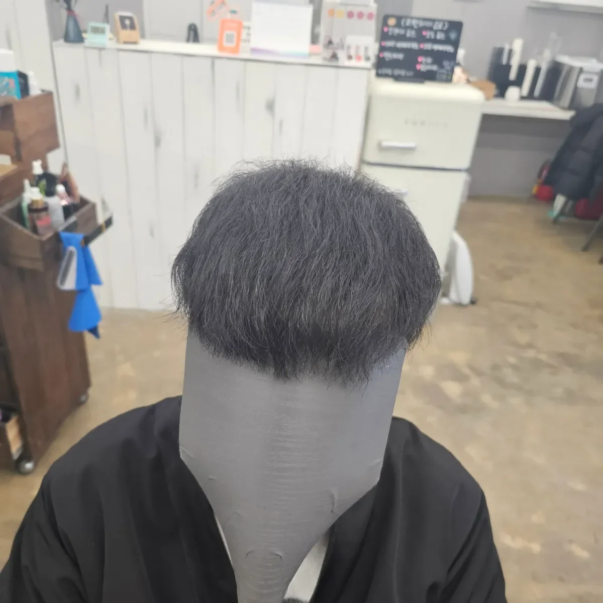 탈모 치트펌 시술 후 산본 정수리 탈모 결과