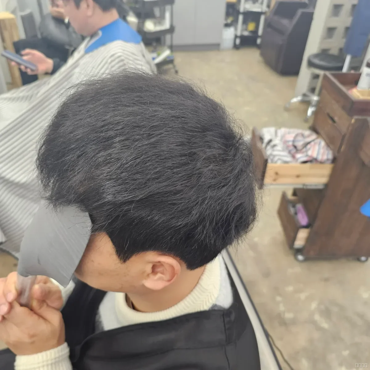 탈모 치트펌 시술 후 결과 사진 2