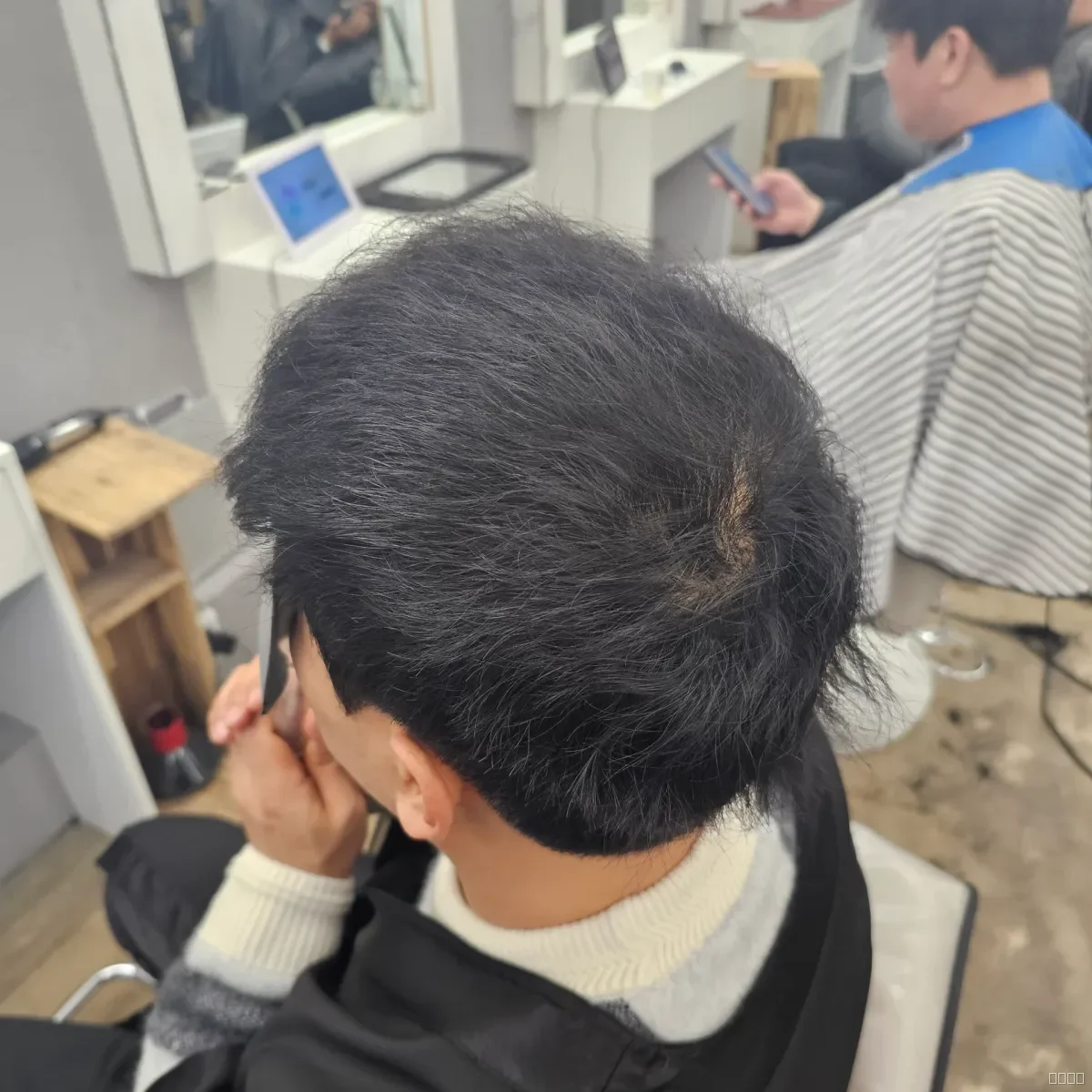 탈모 치트펌 시술 후 결과 사진 3