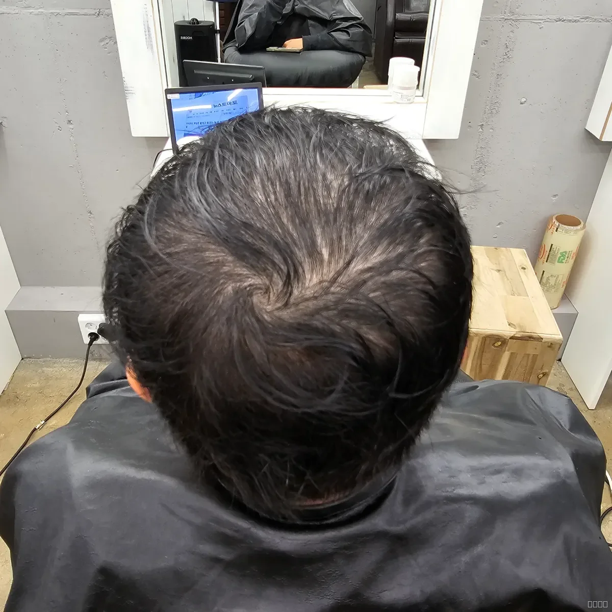 두피페인팅 (치트염색) 시술 전 두피페인팅 모습