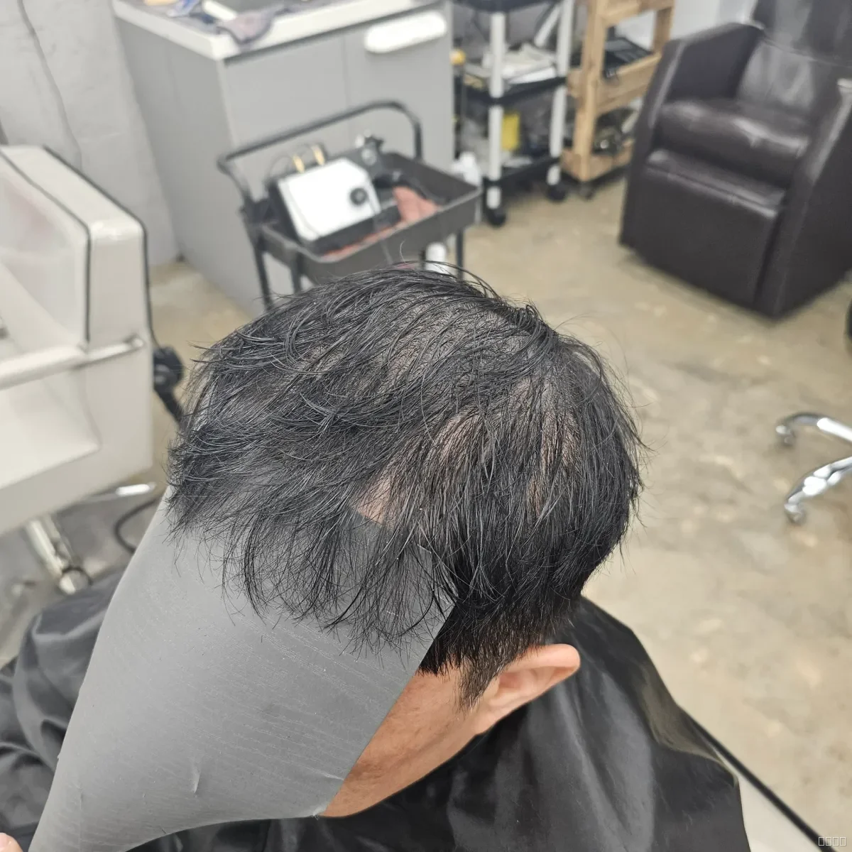 두피페인팅 (치트염색) 시술 전 사진 2