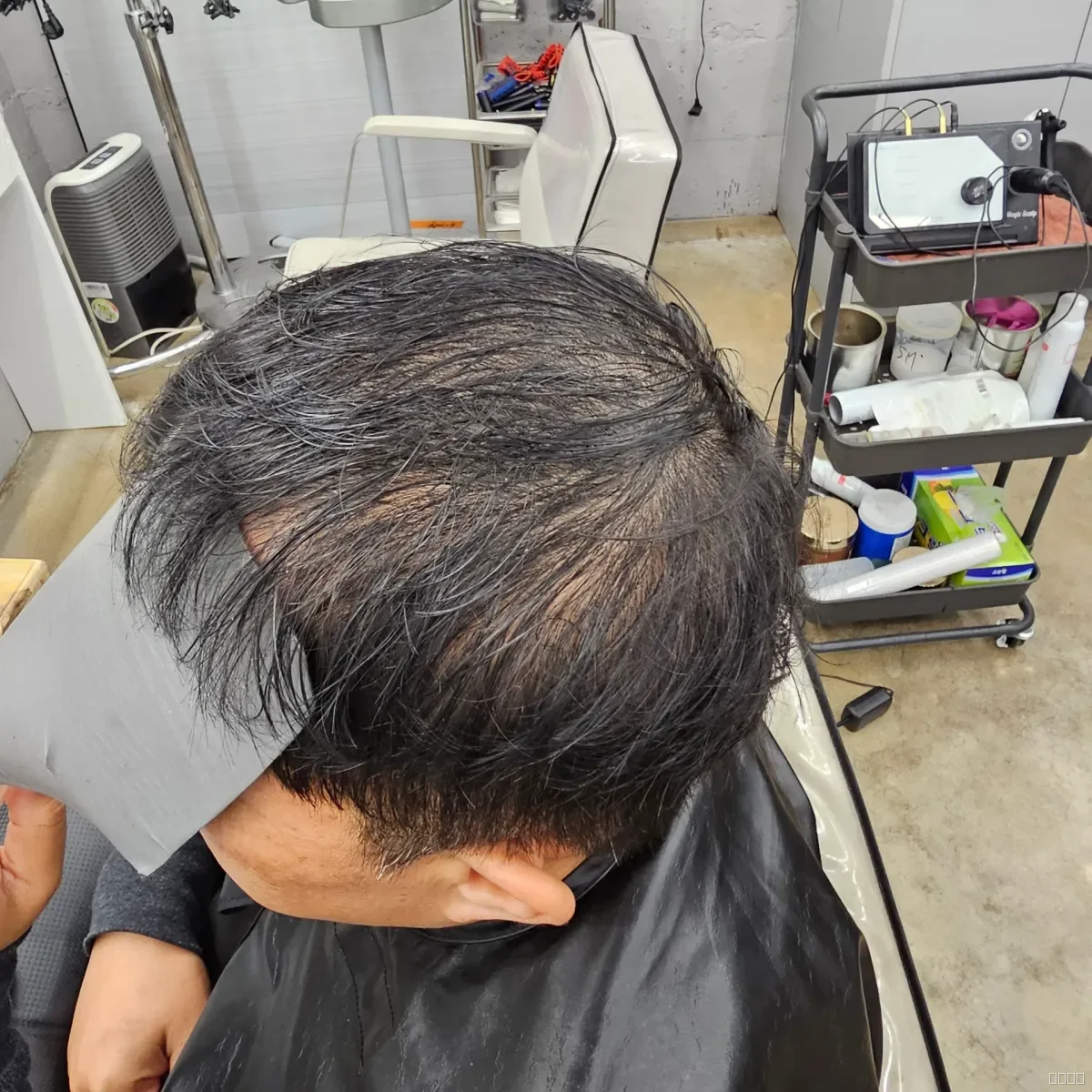 두피페인팅 (치트염색) 시술 전 사진 3