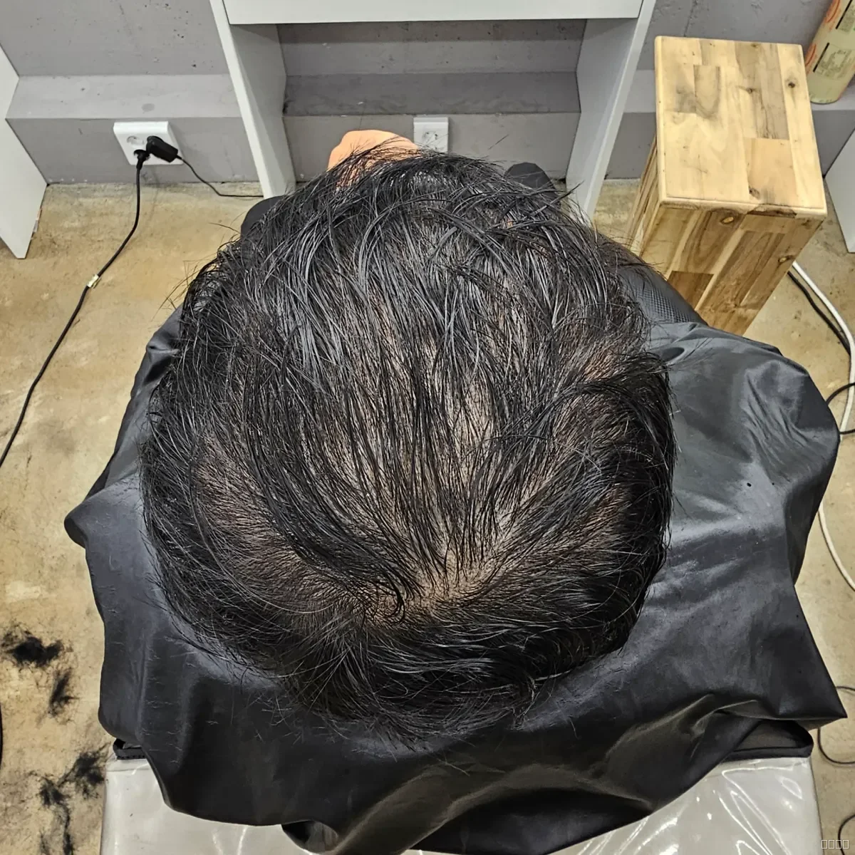두피페인팅 (치트염색) 시술 전 사진 5