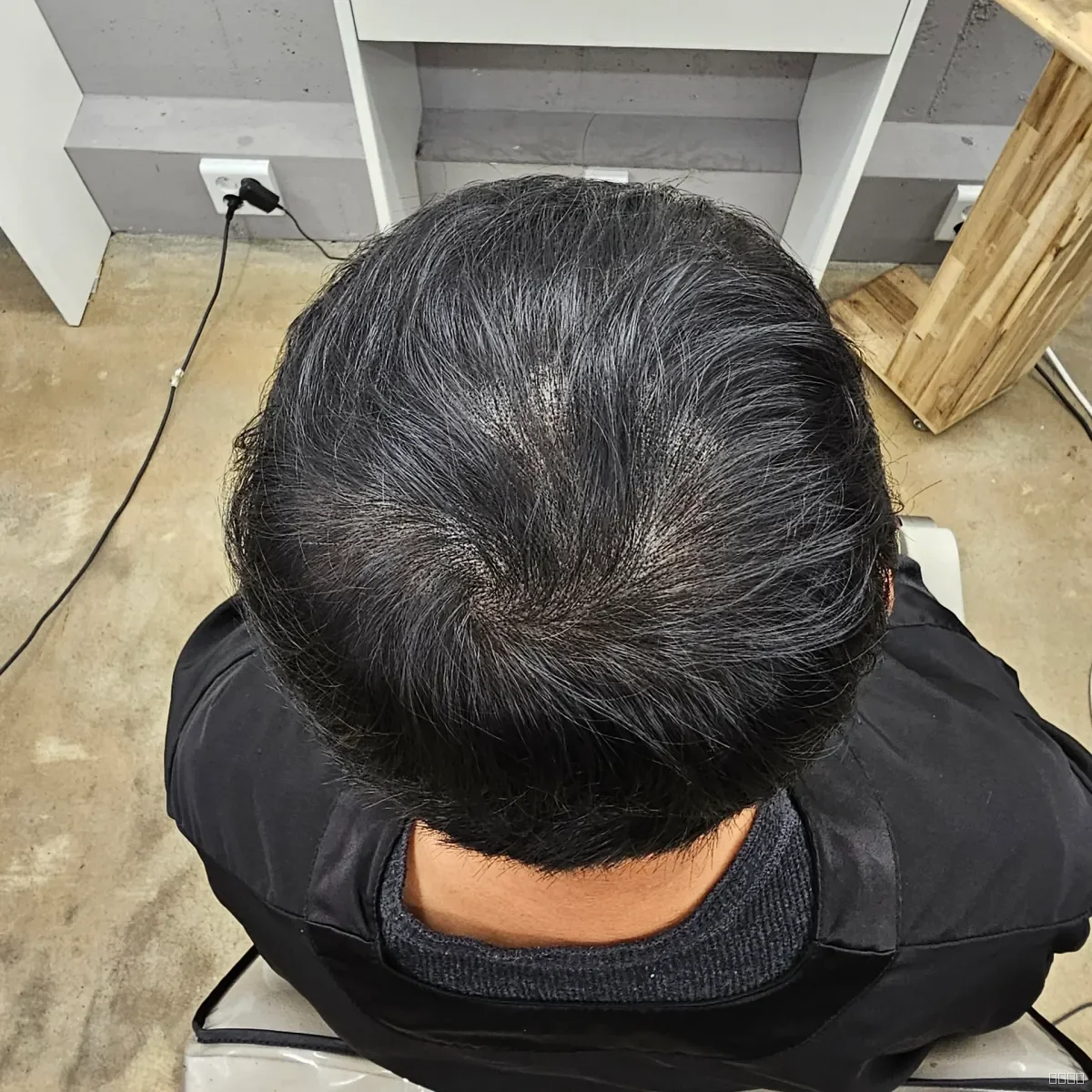 두피페인팅 (치트염색) 시술 후 결과 사진 4