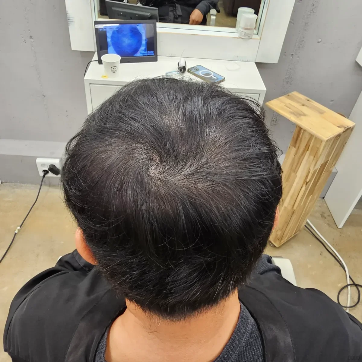 두피페인팅 (치트염색) 시술 후 결과 사진 5