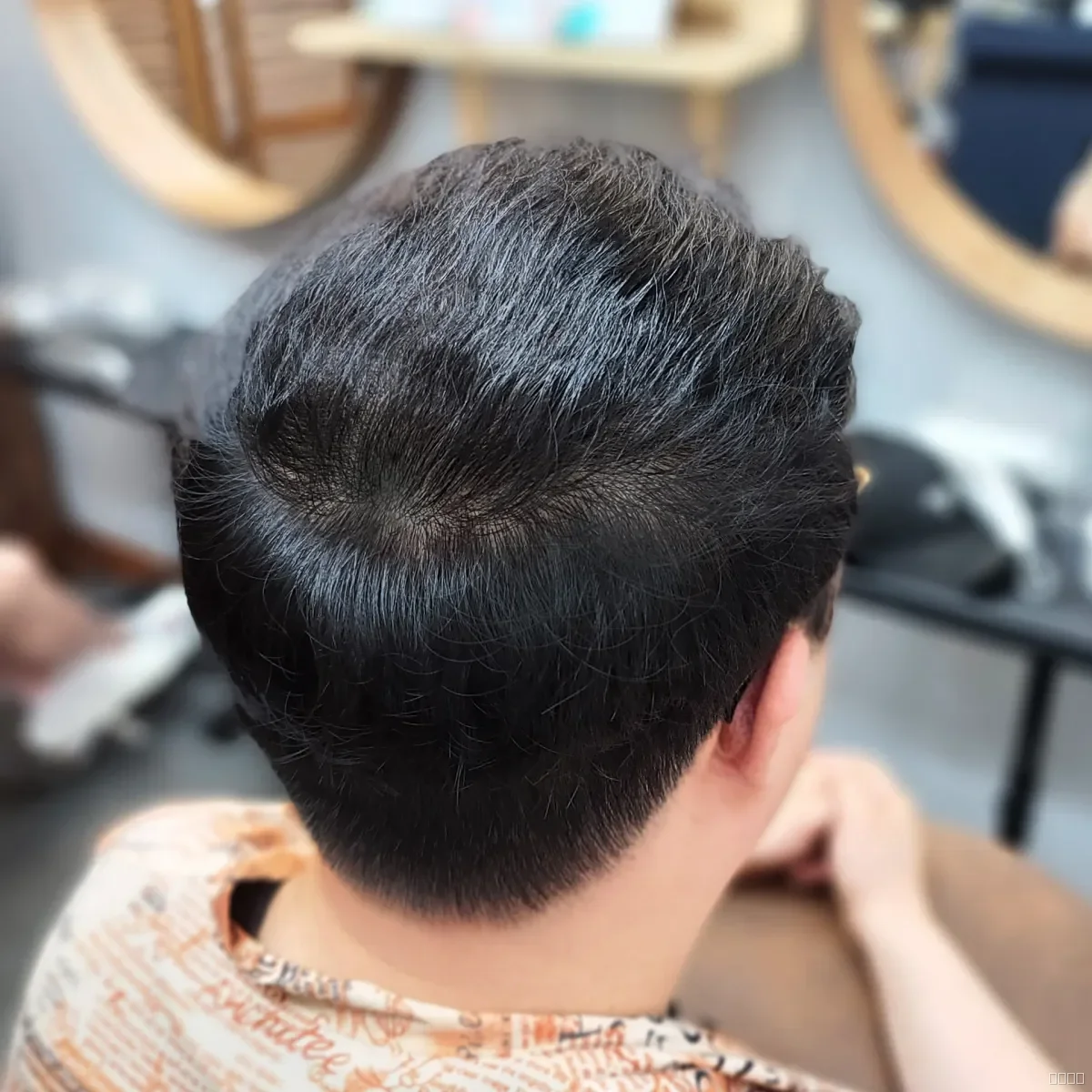 탈모 치트펌 시술 후 산본 탈모펌 결과