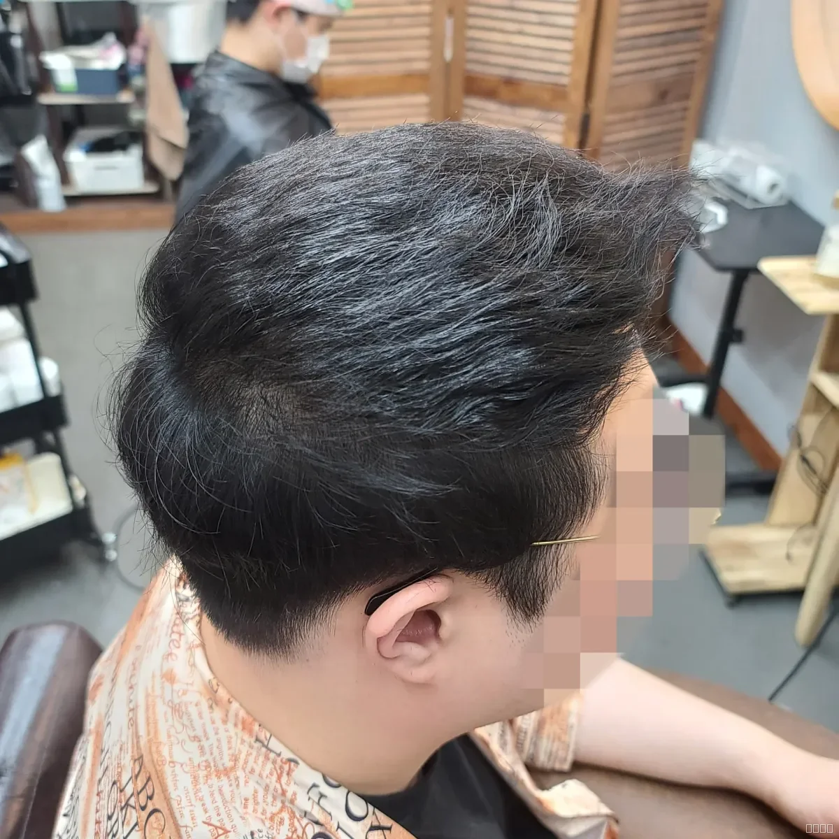 탈모 치트펌 시술 후 결과 사진 2