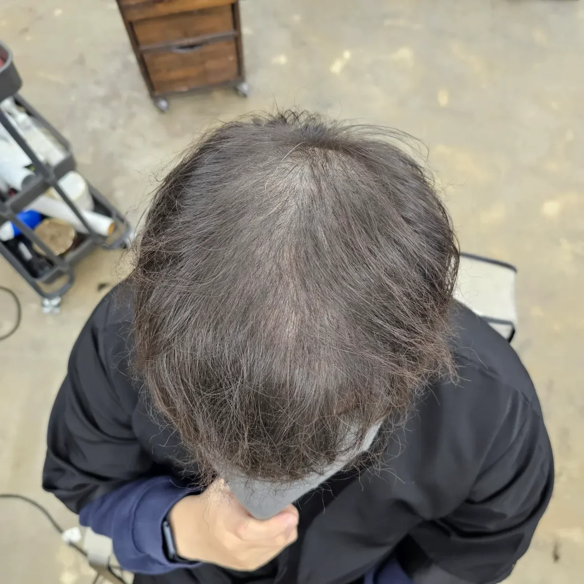 두피페인팅 (치트염색) 시술 전 사진 1