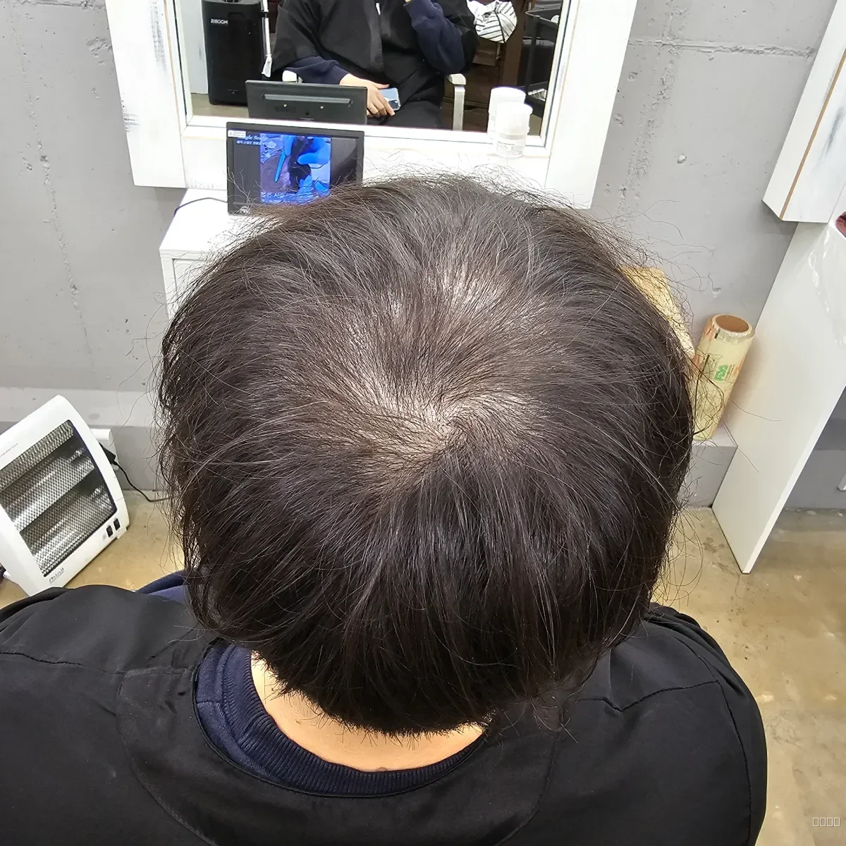 두피페인팅 (치트염색) 시술 전 사진 2