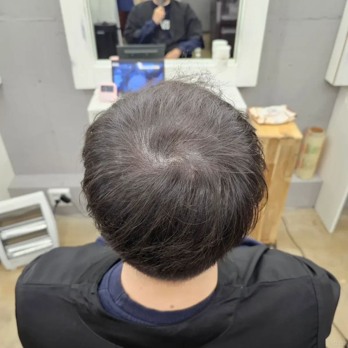 두피페인팅 (치트염색) 시술 후 결과 사진 5